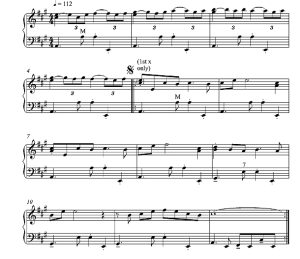 标价非售价 定是他 阿洛伊斯版 手风琴独奏 有试听-云音圈